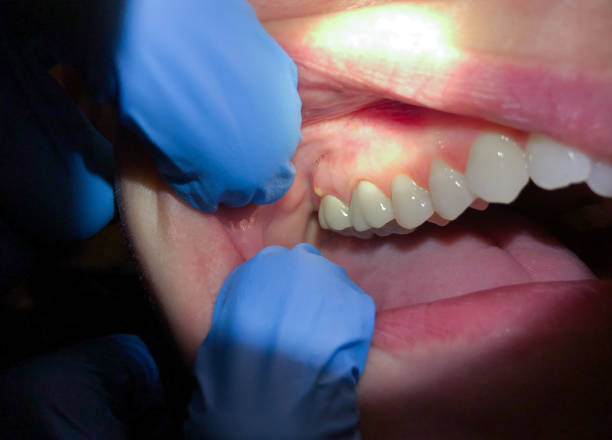 Best Emergency Dentist for Special Needs Patients in Forest Glen, MD